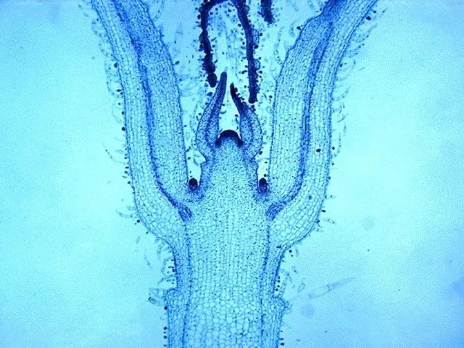 микроскопическое строение верхушечной почки